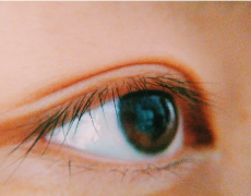 倒睫是由什么原因引起的？