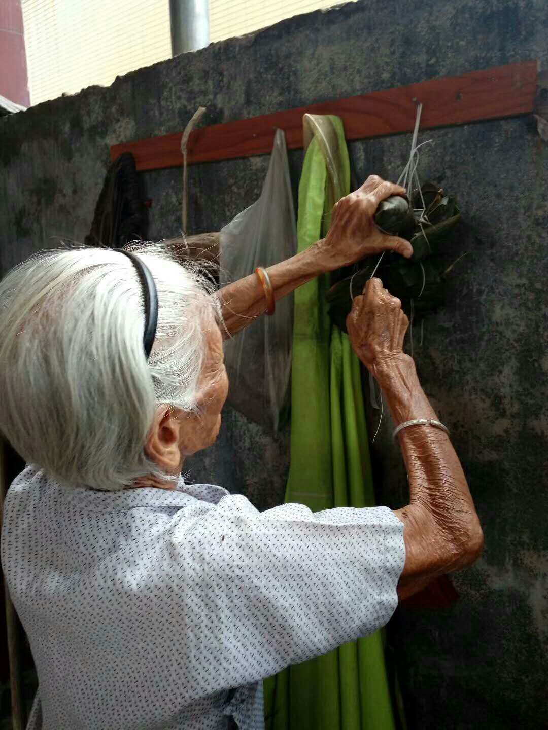 百歲阿婆做白內障手術(shù)